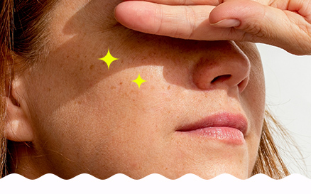 BLACKHEADS & PORE ISSUES