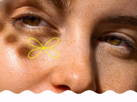 DRY, DEHYDRATED, AND LIPID-DEFICIENT SKIN