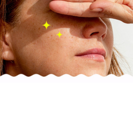 Blackheads & Pore issues