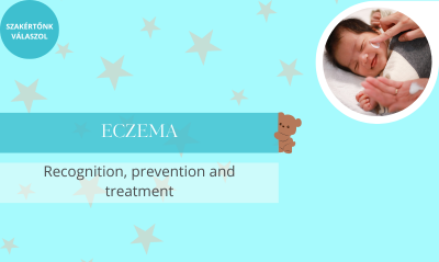 Eczema in babies: causes, symptoms, and prevention