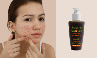 Clear skin with JimJams CLEAN and MATT Black Soap