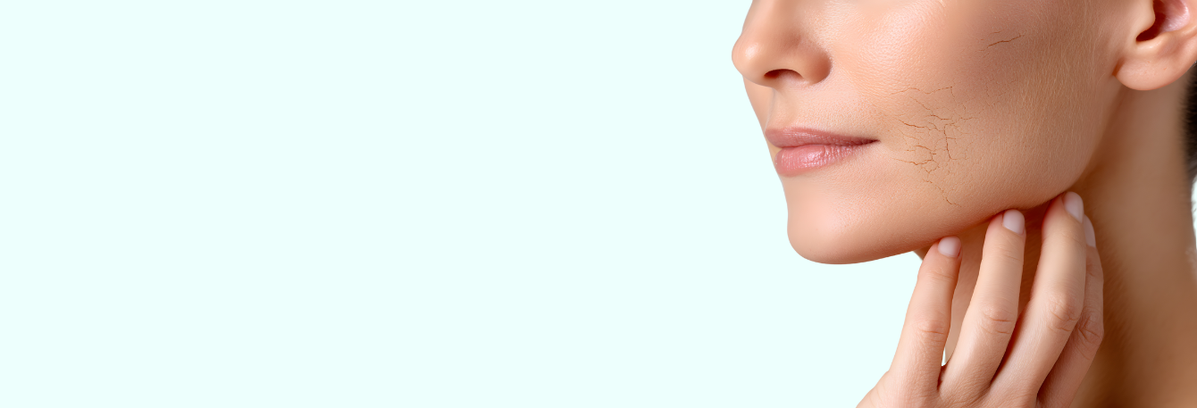 Taking care of dry skin