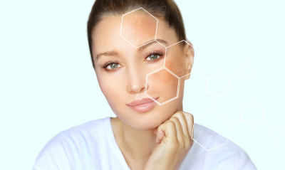 Taking care of combination skin